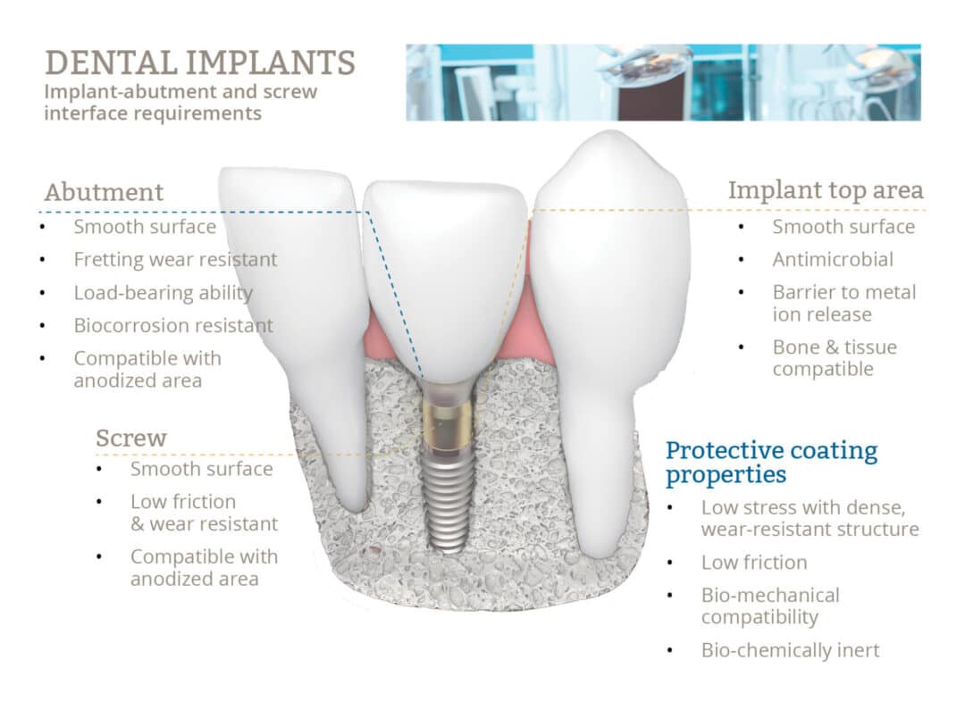 Increase Implant Longevity with Biofunctional Dental Implant Coatings